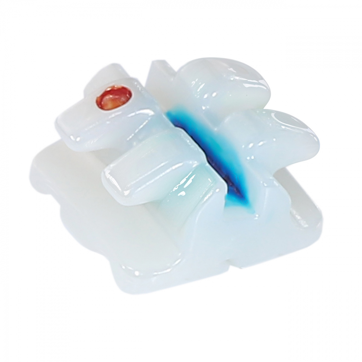 Брекеты COBY STR-U1L-022 из диоксида циркония 27841RU