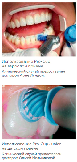 Чашечки Pro-Cup Latch-Type жесткие 991/120