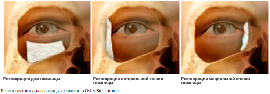 lamina2.jpg