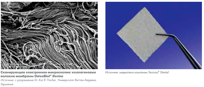 derma-fine2.jpg derma-fine2.jpg