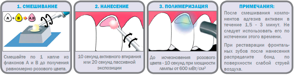 one-up-bond-f-plus.jpg
