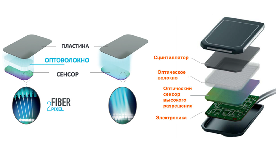 satelec-acteon-group-sopix2-4.png