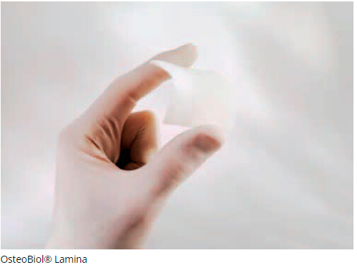 ost-lamina.jpg