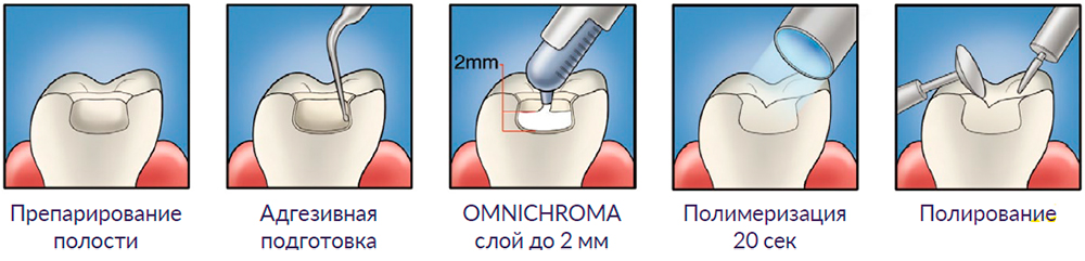 omni-2.jpg