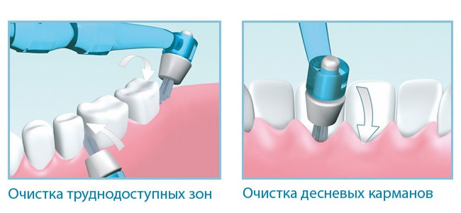 I-Prox-P-02123.jpg