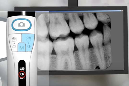 good-drs-whicam-story3-wireled-opisanie2-blackwhite.jpg good-drs-whicam-story3-wireled-opisanie2-blackwhite.jpg