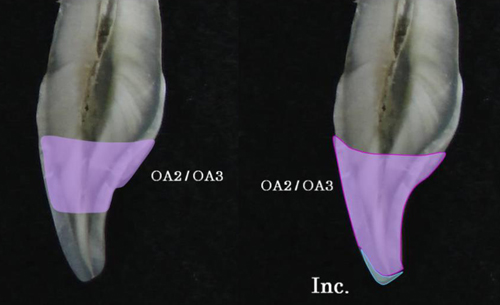palfic-2.jpg