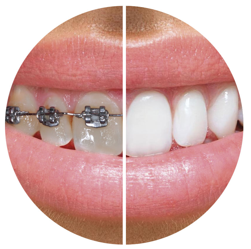 teeth-2.jpg