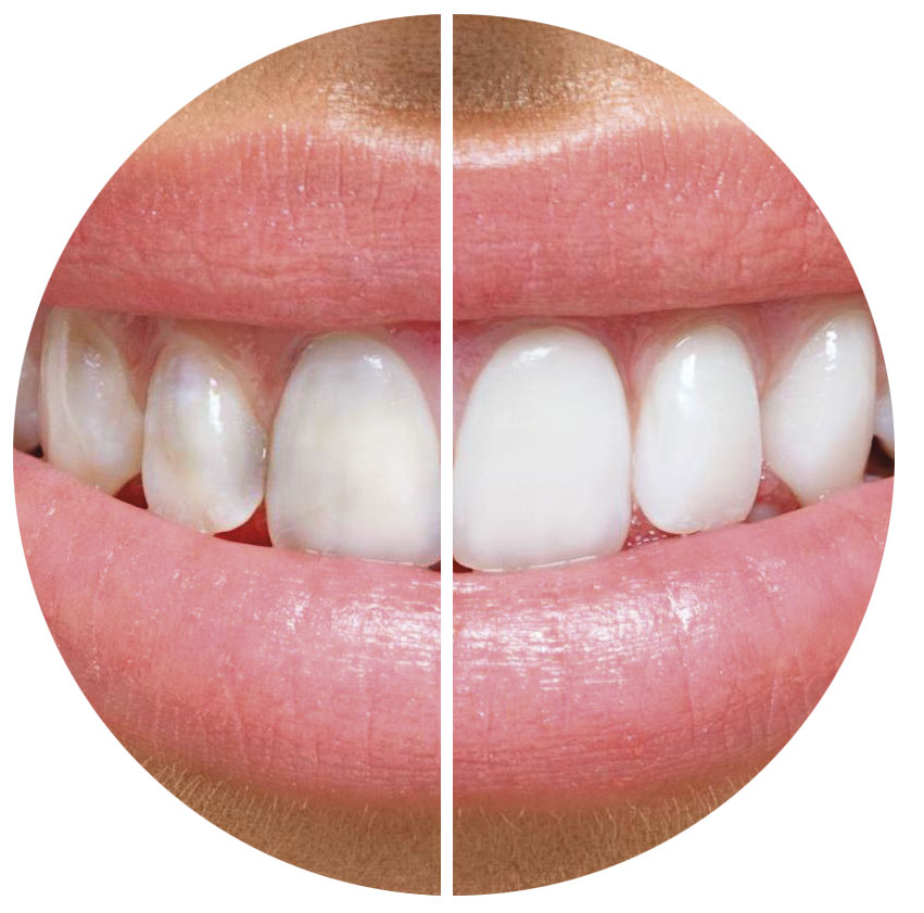 teeth-1.jpg