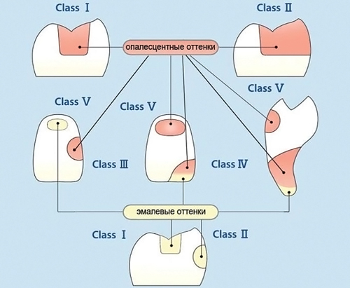 palfic-4.jpg
