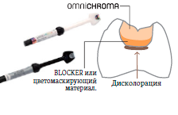 Omnichroma-blocker3.png